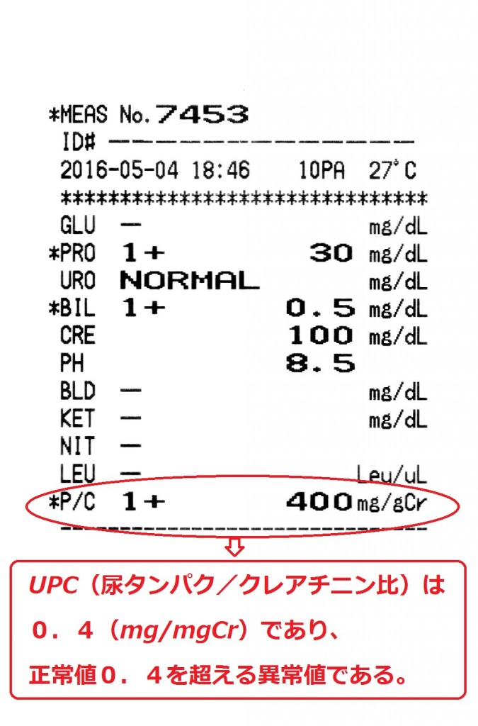 UPC高値症例’