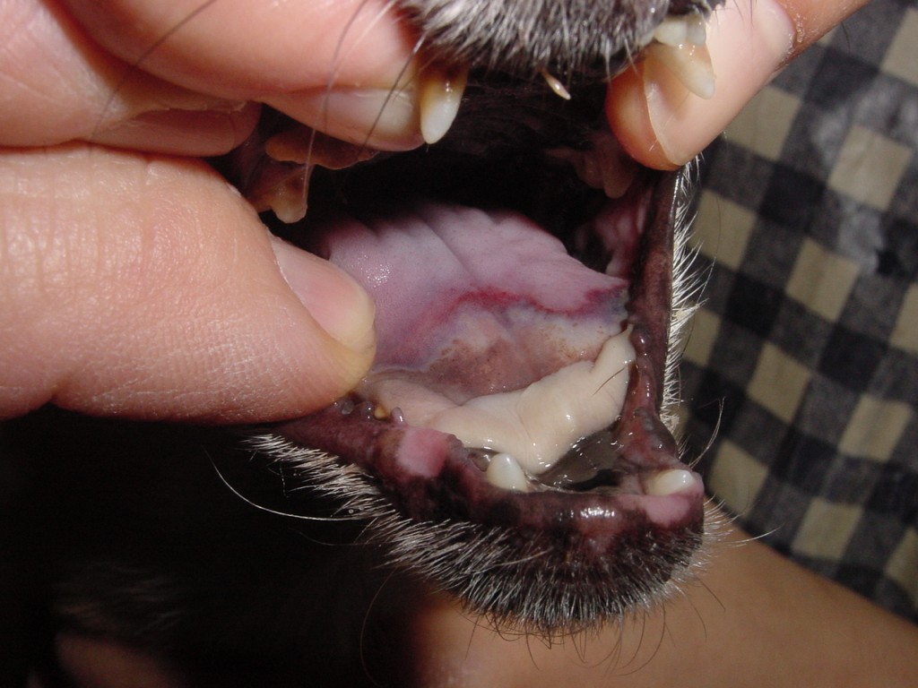 尿毒症性舌潰瘍