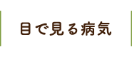 目で見る病気